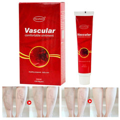 VARICOSE VEINS REMOVAL CREAM - Ofcours For Women