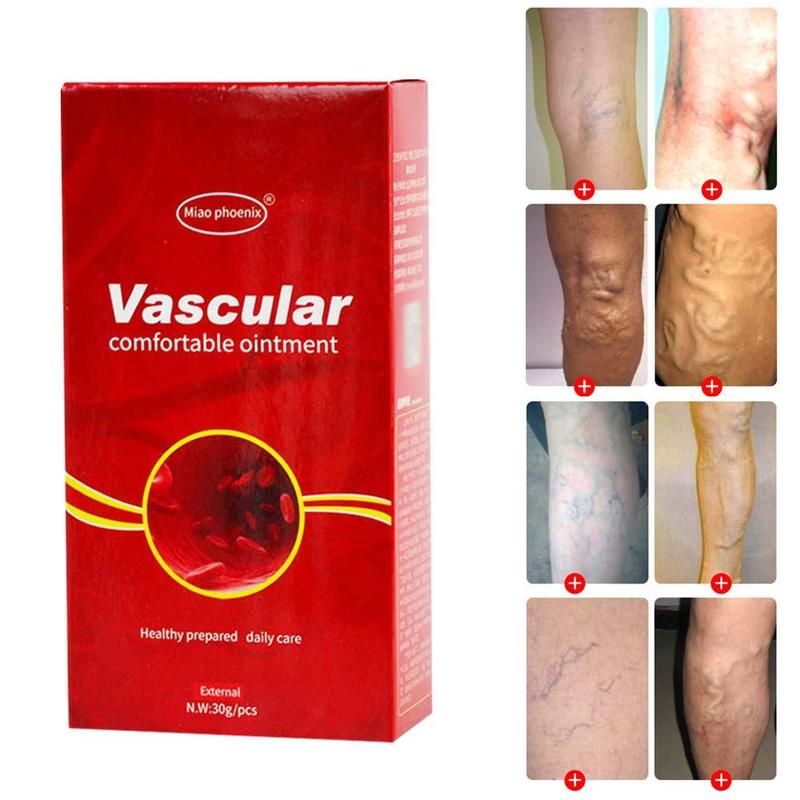 VARICOSE VEINS REMOVAL CREAM - Ofcours For Women