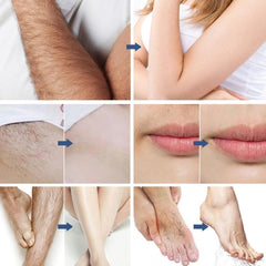 Hair Removal - Ofcours For Women